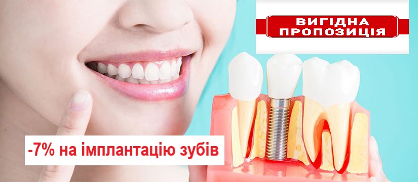 Знижка на імплантацію зубів